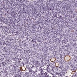ZP4 Antibody, Novus Biologicals 25 &mu;L; Unlabeled:Antibodies, Polyclonal